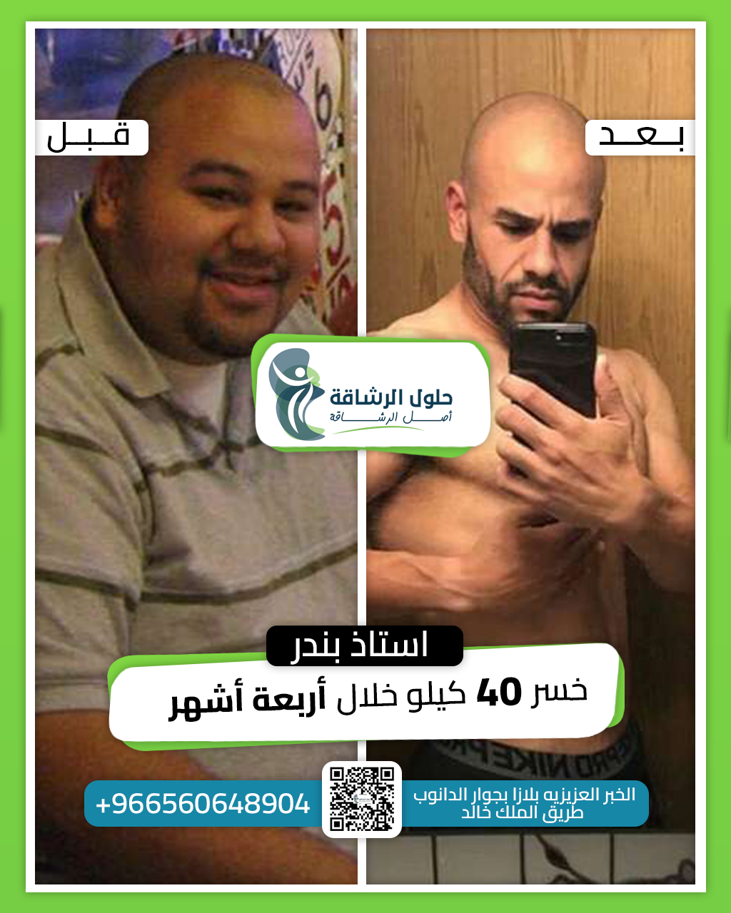 Before And After [2]