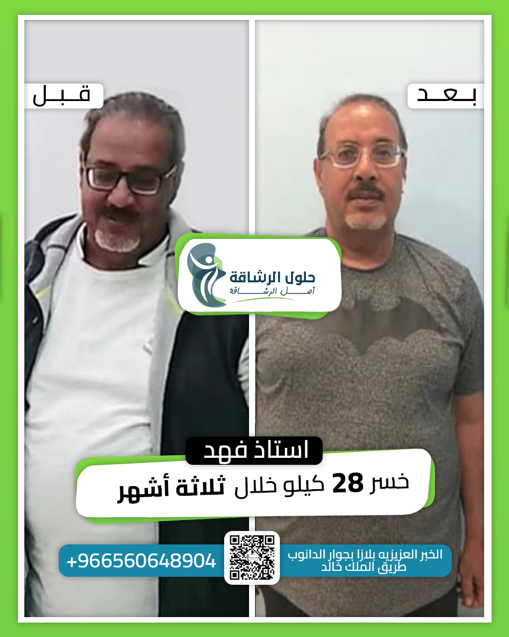 Before And After [3]