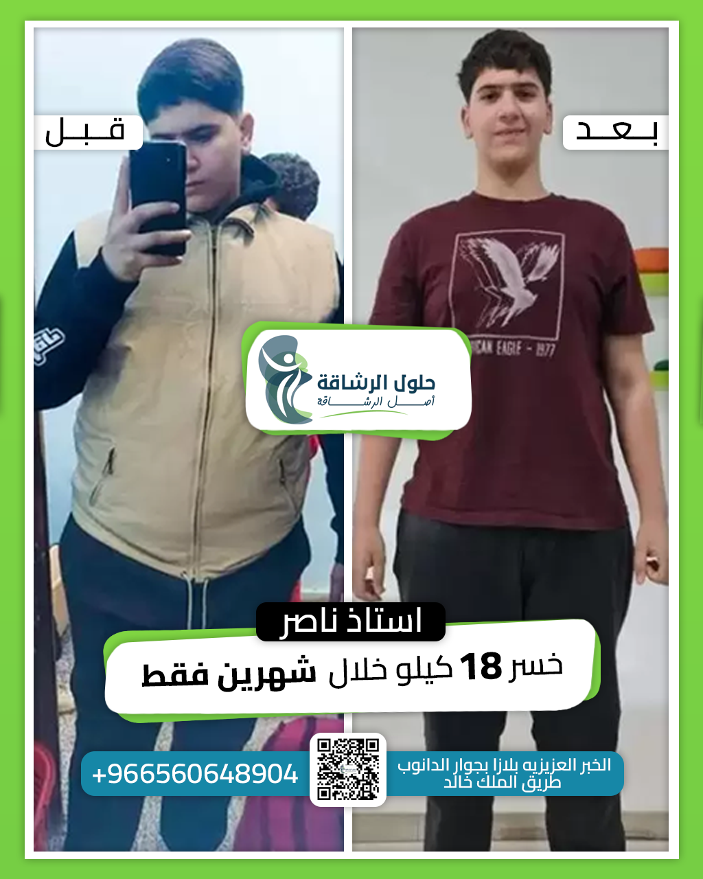 Before And After [4]